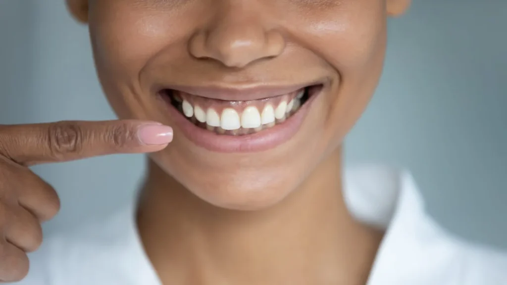 Smile Restoration in Australia: Comparing Porcelain Veneers and All-on-4® Dental Implants with Your Cosmetic Dentist