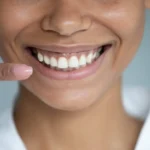 Smile Restoration in Australia: Comparing Porcelain Veneers and All-on-4® Dental Implants with Your Cosmetic Dentist